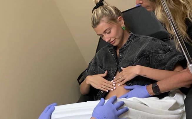 Justin Bieber lua nguoi ham mo ve viec Hailey Baldwin mang bau hinh anh