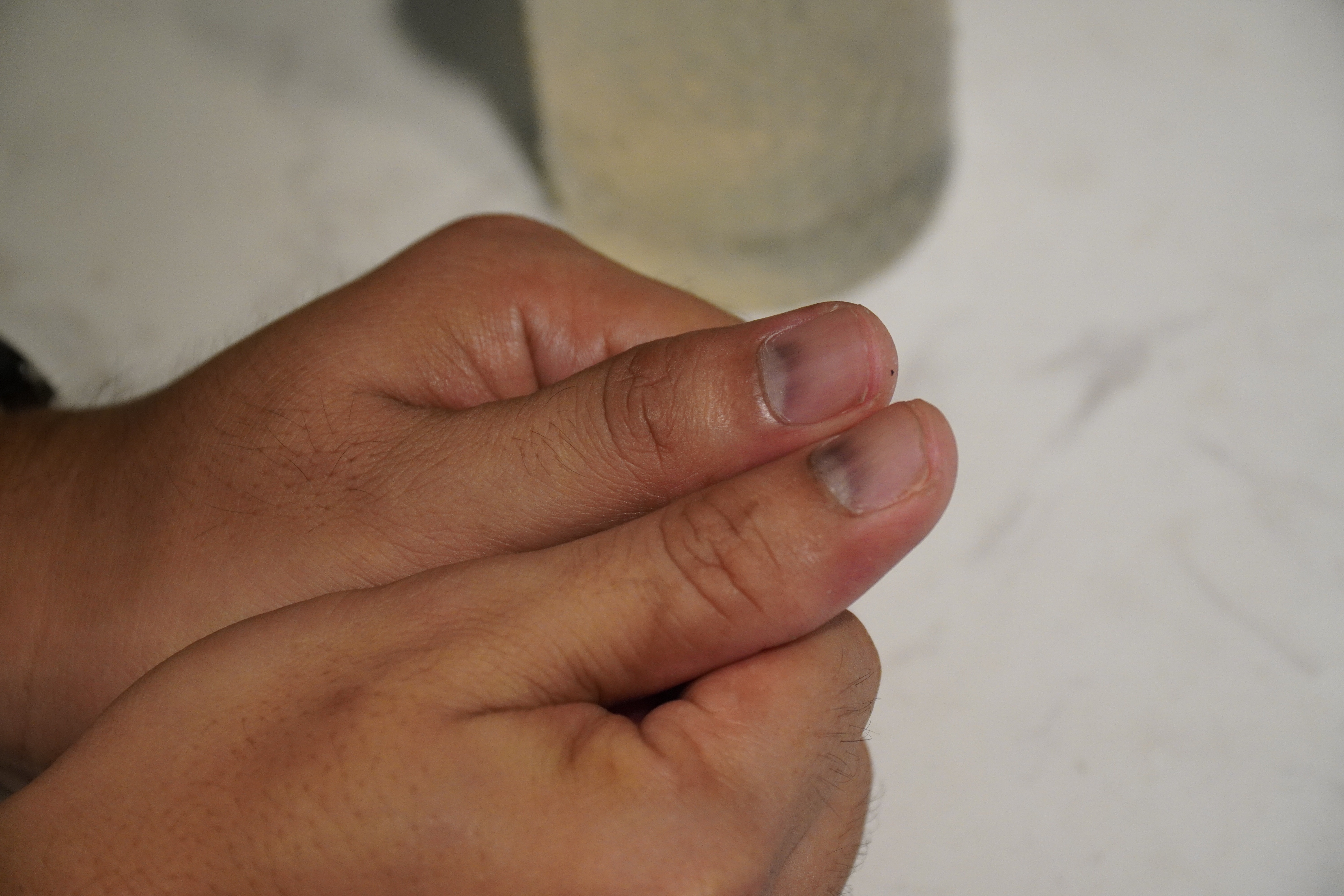 Duc Thinh mac ung thu anh 4