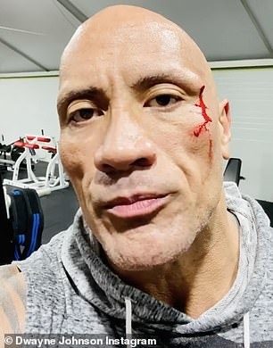 The Rock bị thương ảnh 1 The Rock bi thuong anh 1