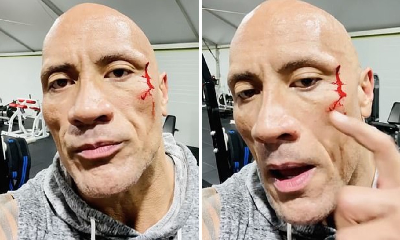 The Rock bi thuong khi tap the hinh hinh anh