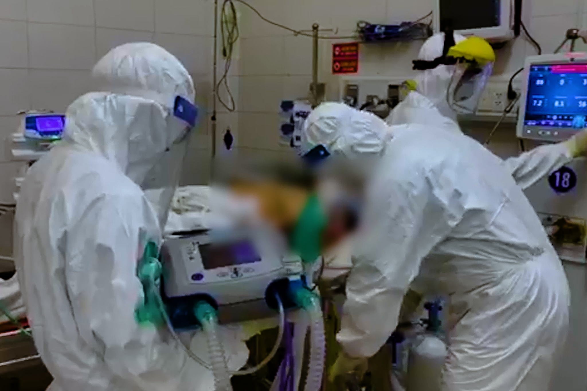 Canh dat ECMO cho benh nhan mac Covid-19 tai Da Nang hinh anh