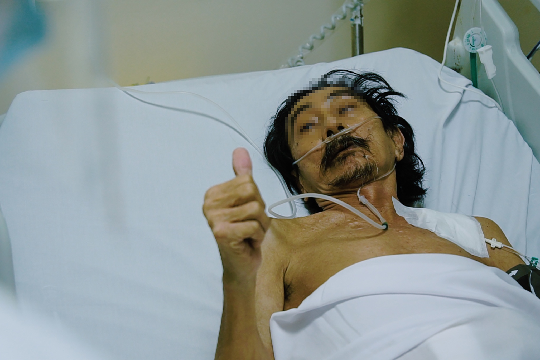 Lan dau tien mo cap cuu F0 nguy kich tai Benh vien Hoi suc Covid-19 hinh anh