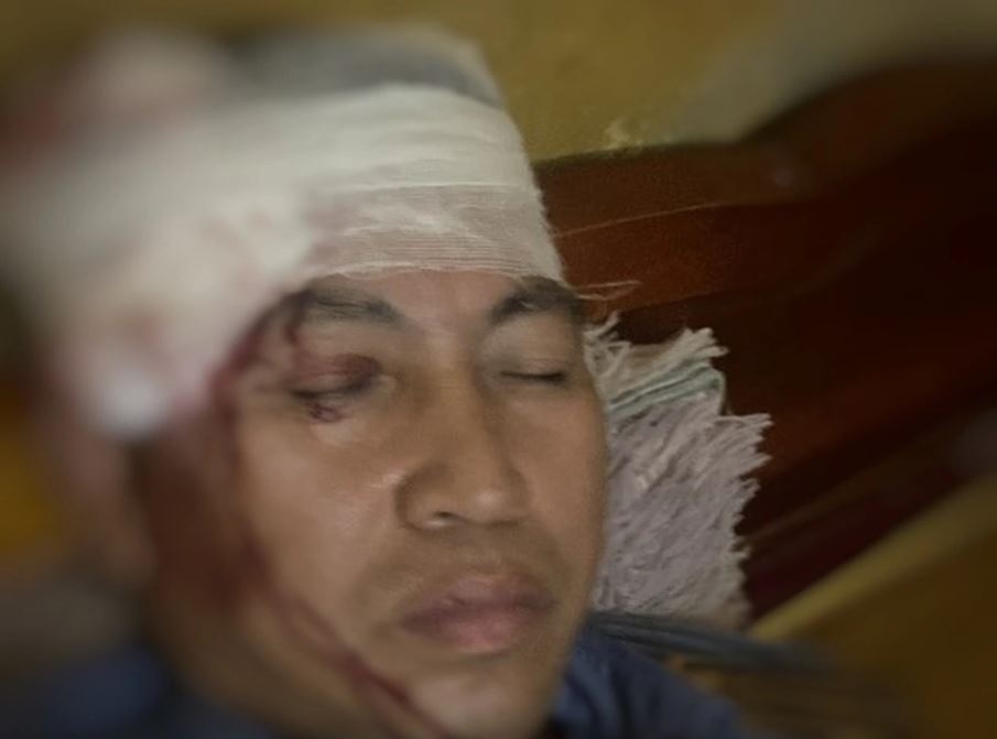 Phu lai tau hoa bi nem da trung dau o Yen Bai hinh anh