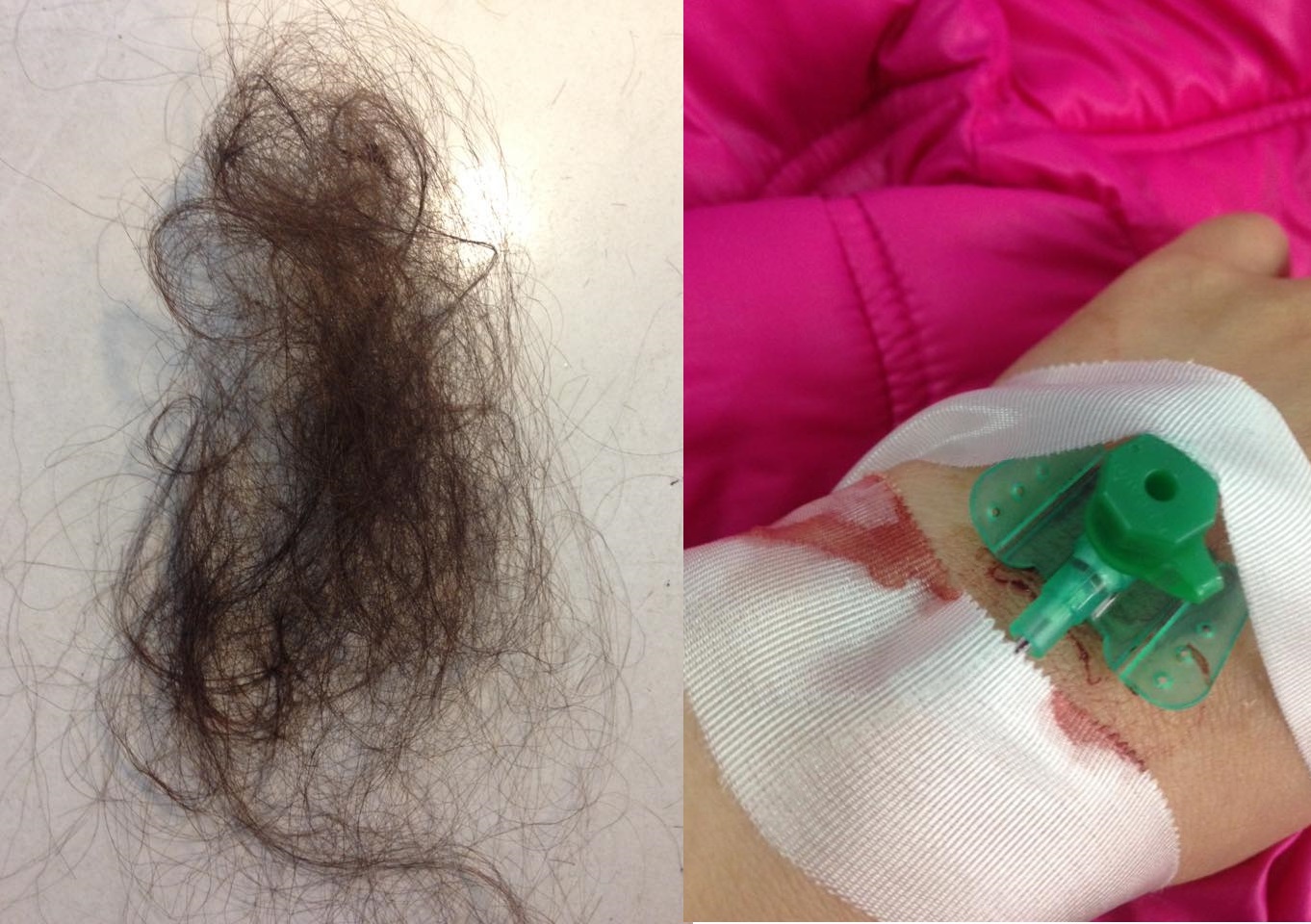 nhật ký chiến đấu ung thư của cô giáo trẻ ảnh 2 nhat ky chien dau ung thu cua co giao tre anh 2