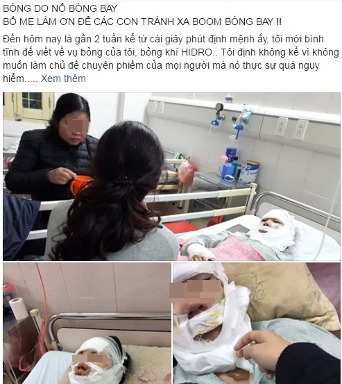 cô gái bị bỏng do nổ bóng bay ảnh 1 co gai bi bong do no bong bay anh 1