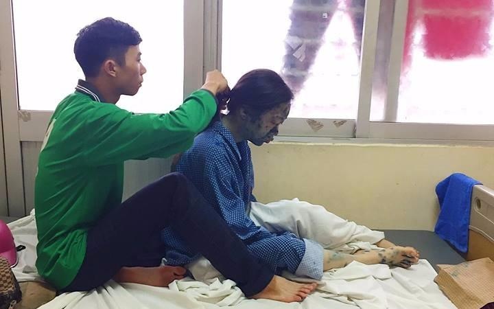 Chang trai long ngong tet toc cho ban gai bi thuy dau trong benh vien hinh anh