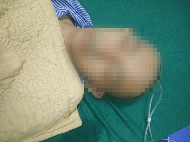 Hoc sinh bi danh chan thuong so nao: So GD&DT Ha Giang noi gi? hinh anh