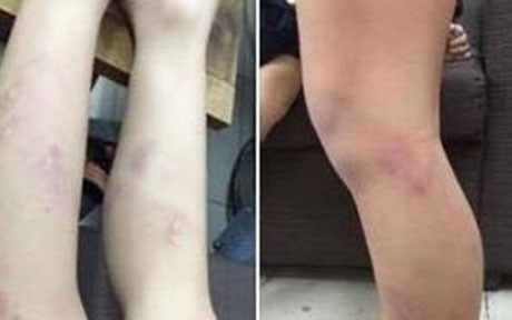 Phu huynh chap nhan loi xin loi cua co giao danh lien tiep hoc sinh hinh anh