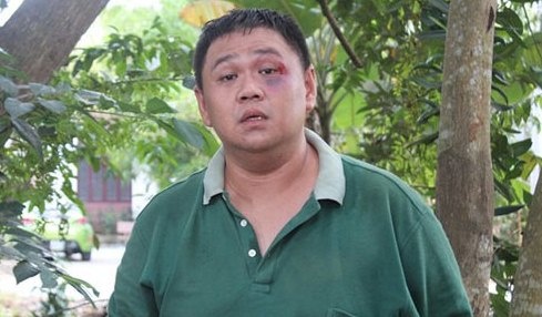 Nghi si California trinh du luat moi vi vu Minh Beo hinh anh