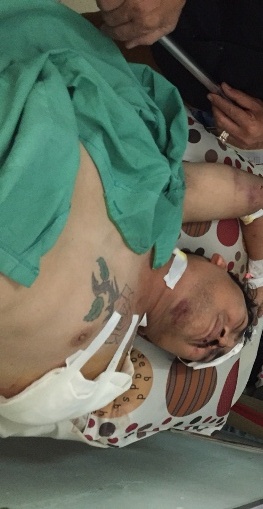 Ca si Viet bi tai nan mat canh tay o trong can phong 5 m2 hinh anh