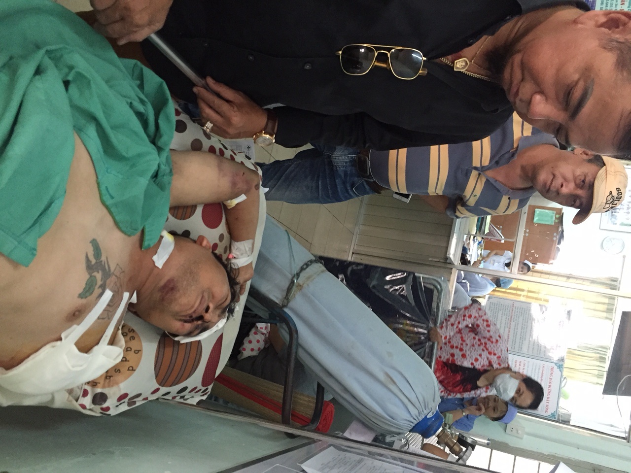 Ca sĩ Nhật Linh mất một cánh tay ảnh 1 Ca si Nhat Linh mat mot canh tay anh 1