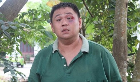 '18 thang tu la muc an nang voi Minh Beo' hinh anh