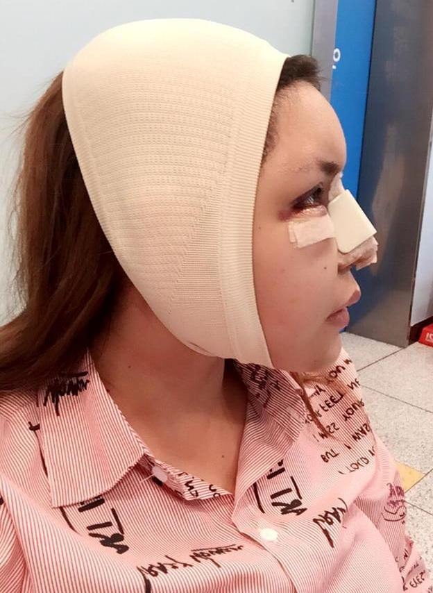 Xuân Nghi phẫu thuật toàn cơ thể ảnh 1 Xuan Nghi phau thuat toan co the anh 1