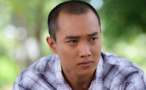 Dien vien Quoc Truong bi mo mot mat khi dong phim hinh anh