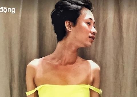 Anh Hai Trieu xanh xao, gay tro xuong khien khan gia hoang so hinh anh