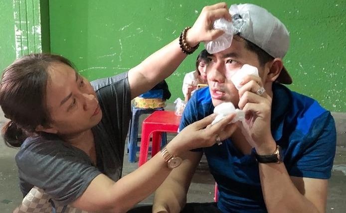 Minh Luan bi nga dap mat xuong san san khau trong buoi tong duyet hinh anh