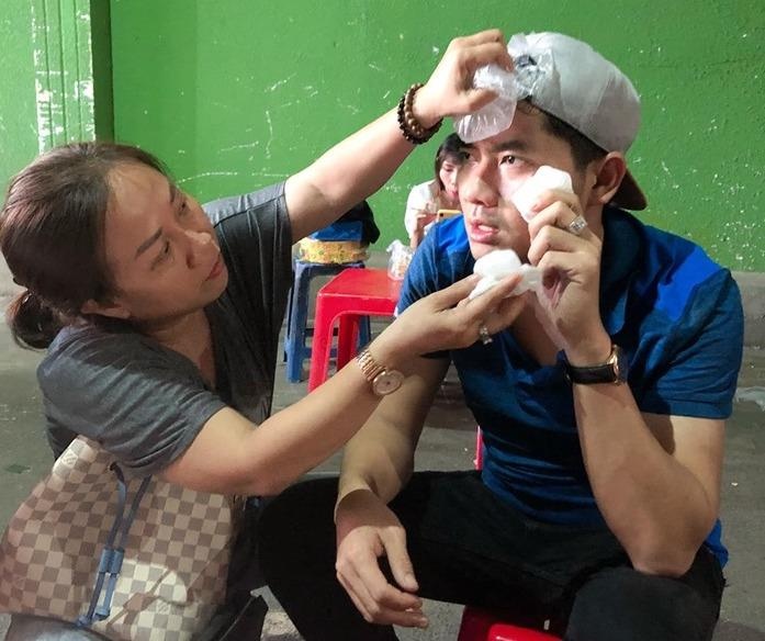 Minh Luan bi nga dap mat xuong san anh 1