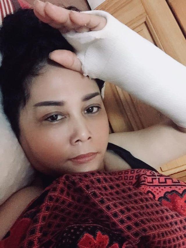 Nghệ sĩ Minh Hằng bị ngã gãy tay ảnh 1 Nghe si Minh Hang bi nga gay tay anh 1