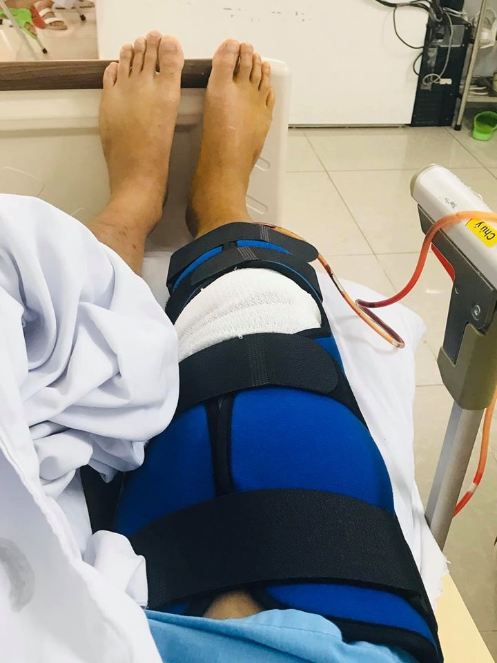 Thanh Duy bi nga cau thang bi dut day chang anh 2