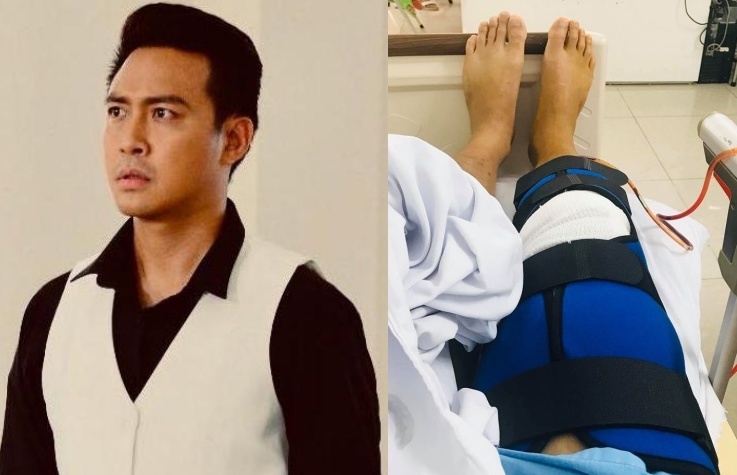 Thanh Duy nga cau thang, bi dut day chang dau goi hinh anh