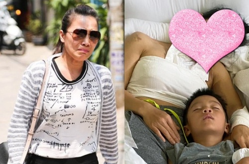 Ca si Hong Ngoc bat dau thay da sau khi bi bong vi no noi xong hoi hinh anh