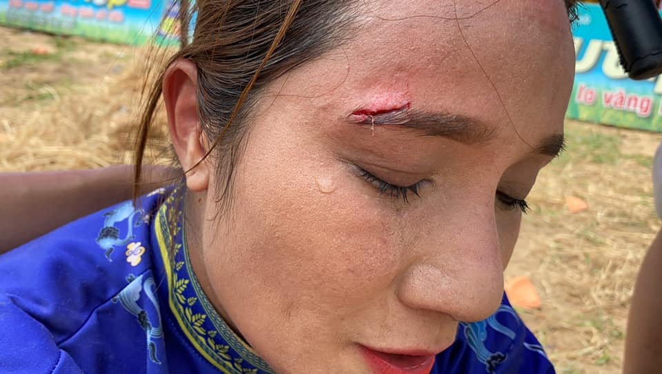 Cat Tuong bi dao cu roi vao mat, phai khau 3 mui khong thuoc te hinh anh