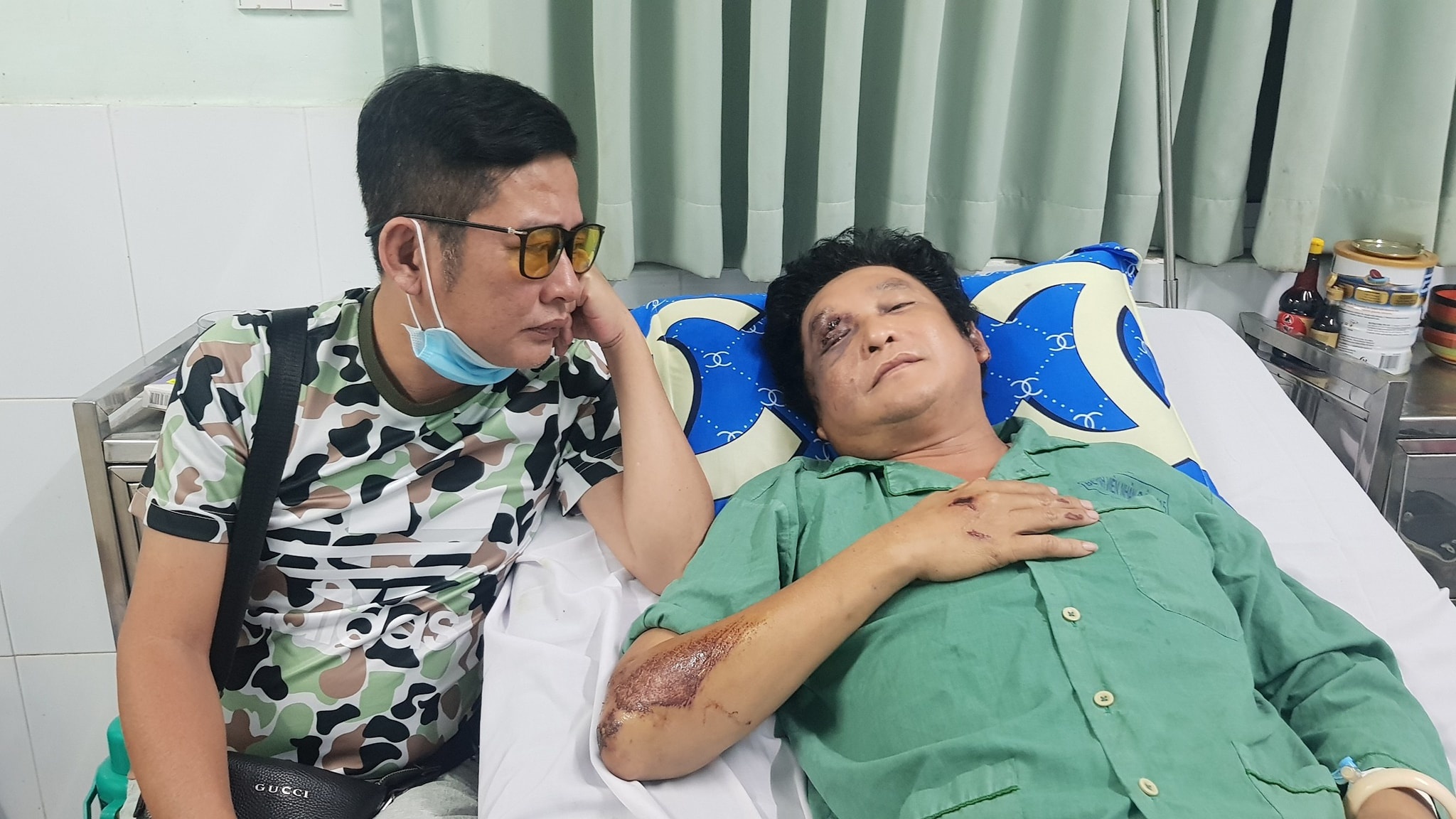 Nghe si Trong Phuc bi tai nan, chan thuong mat va vai hinh anh