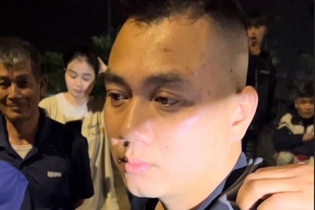 Tai xe say xin anh 1