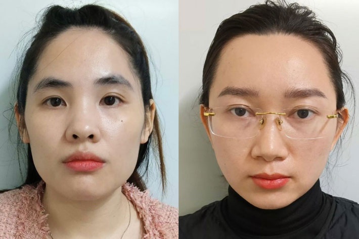 Lua hon 30 ty dong bang chieu ban dong trung ha thao hinh anh