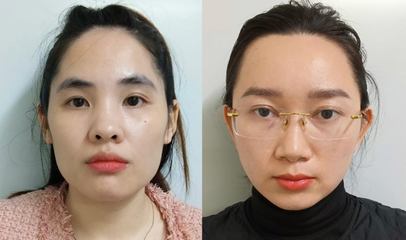 Đông trùng hạ thảo ảnh 1 Dong trung ha thao anh 1