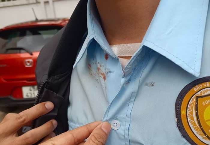 Ten cuop ngan hang o Lam Dong ban bao ve suot qua nguc hinh anh