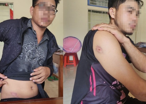 Ba nguoi lai may gat thue bi hanh hung o Quang Tri hinh anh