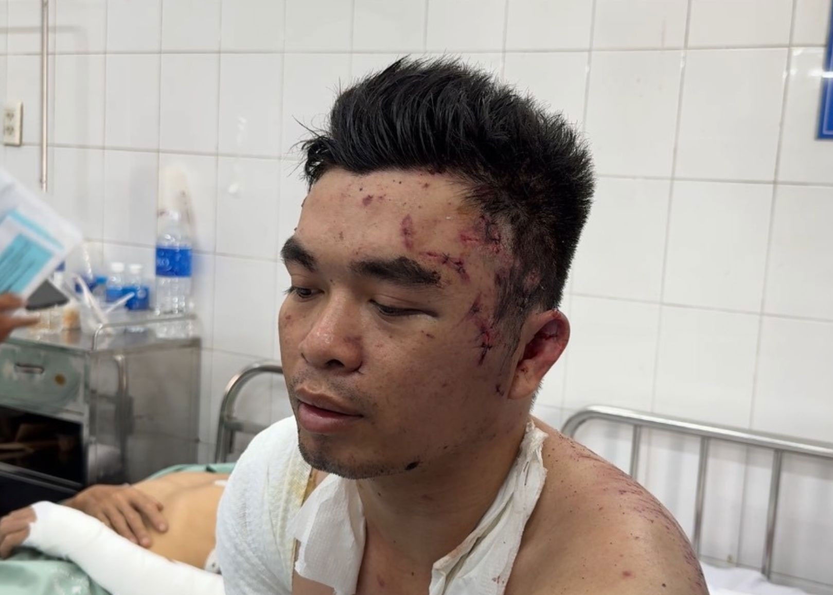 Nan nhan vu no lo hoi lam 6 nguoi tu vong ke ve ngay di lam dinh menh hinh anh