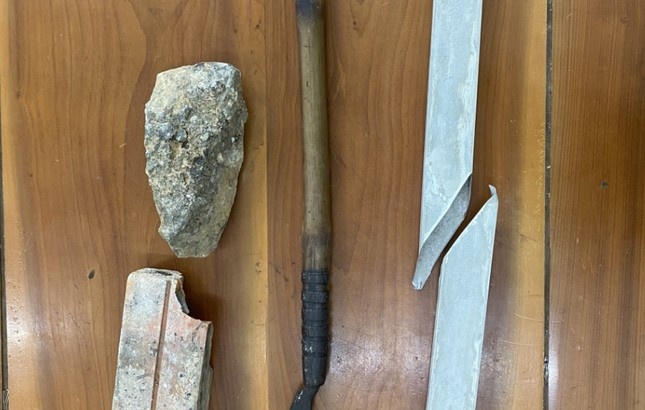 Duoi danh can bo,  Cong an nhap vien anh 2