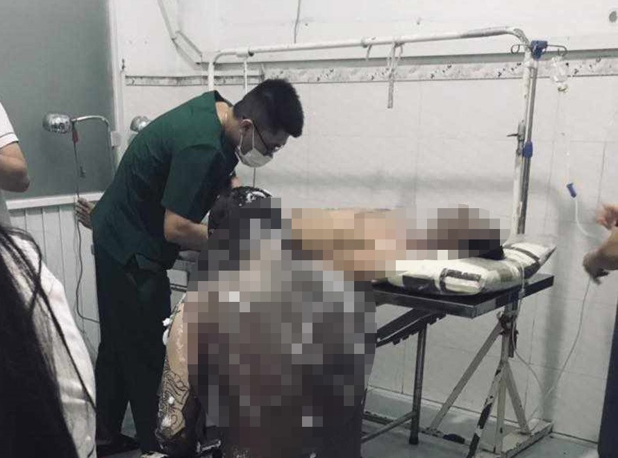 No bon chua bui go, nhieu cong nhan bong nang phai chuyen den TP.HCM hinh anh