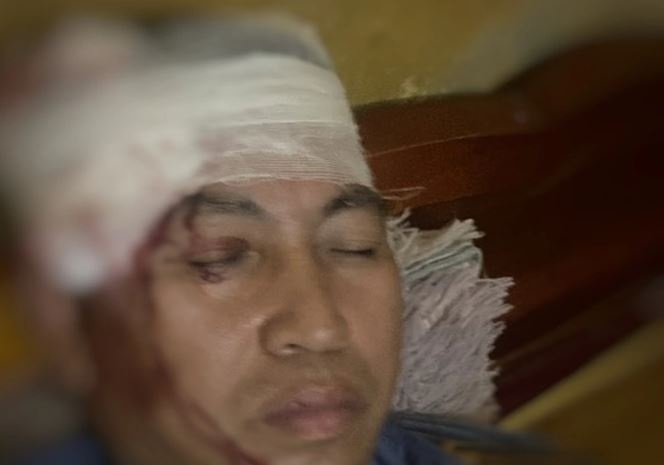 Loi khai cua nhom doi tuong nem vo dau lai phu tau hoa o Yen Bai hinh anh