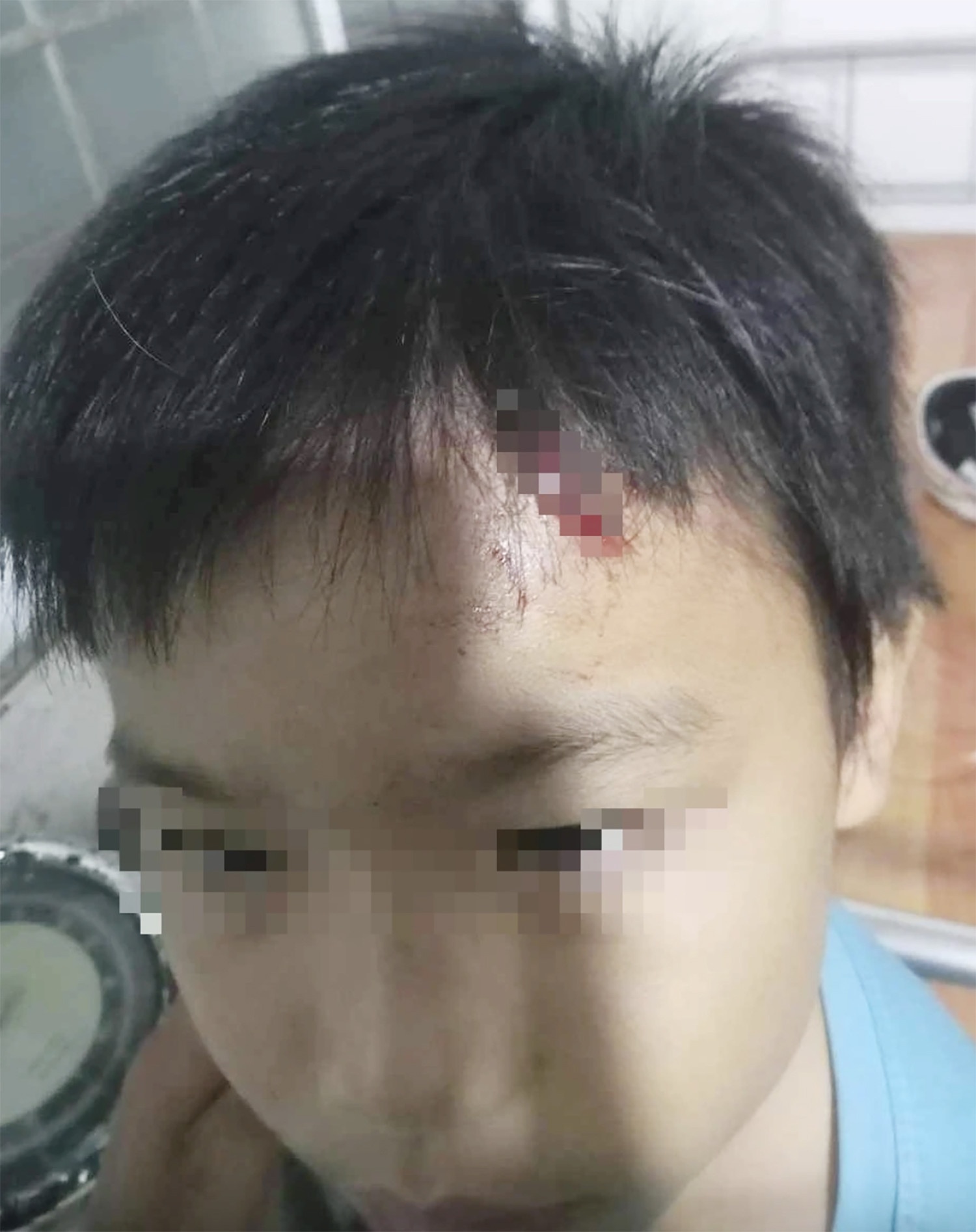 Khoi to,  Be trai 10 tuoi,  Ca Mau anh 2