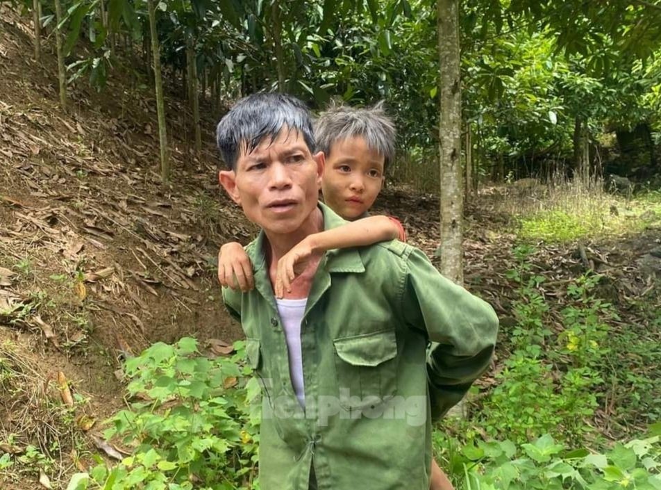 Be 6 tuoi Yen Bai anh 2