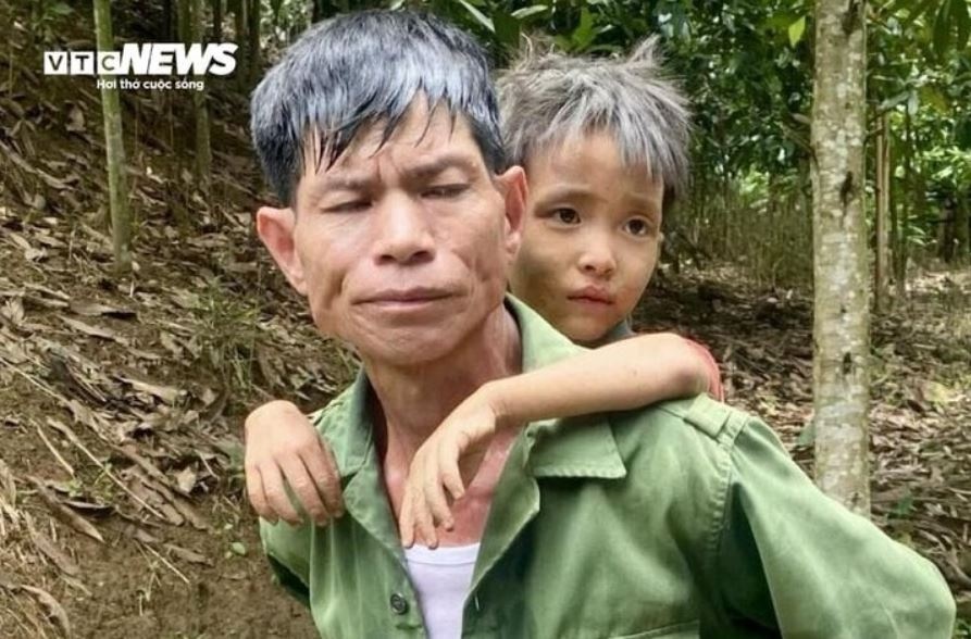 Be 6 tuoi mat tich anh 1