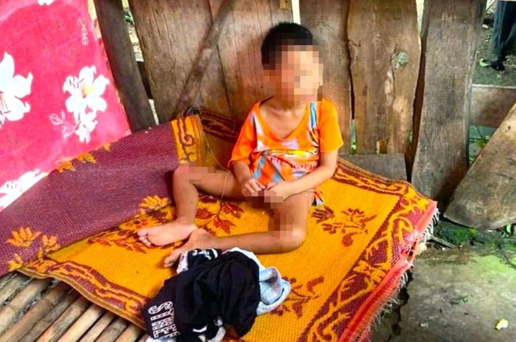 Be 5 tuoi co nhieu vet thuong bi dua ra lan o rieng hinh anh