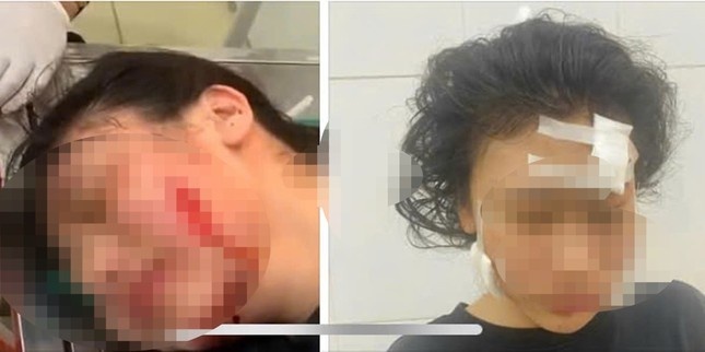 Me no tien,  Con bi rach mat,  Sam Son,  Thanh Hoa anh 1