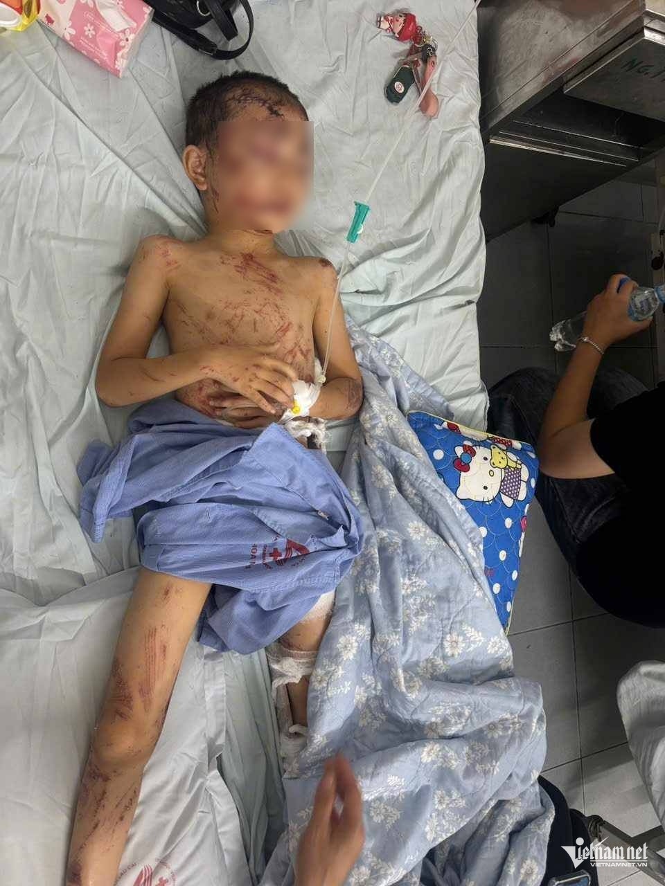 Sat lo Lao Cai anh 1