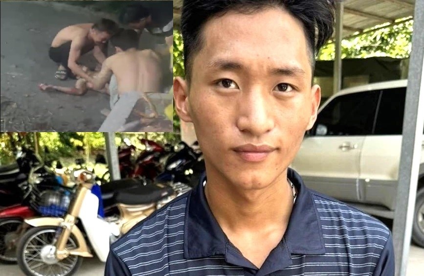 Bat nghi pham chem dut nua nguoi ban nhau hinh anh