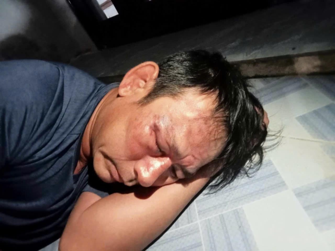 Loi khai nhom doi tuong danh nguoi nhap vien vi lam tho dang Facebook hinh anh