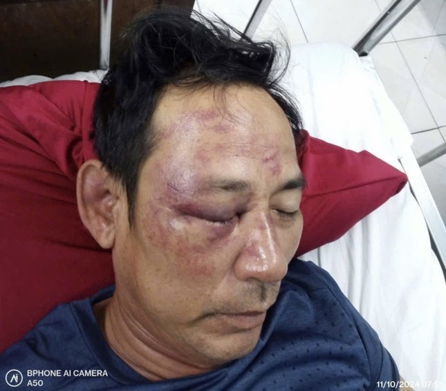 Lam tho dang Facebook,  Ngo Van Lu,  Quang Binh anh 1