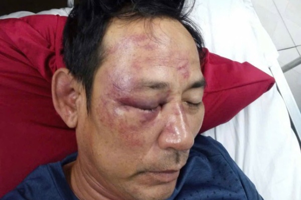 Thong tin moi vu nguoi dan ong bi danh vi lam tho dang Facebook hinh anh