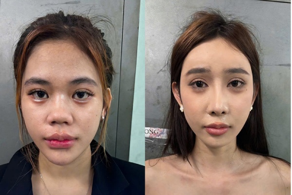 18 doi tuong bi khoi to vi danh nguoi, gay roi o trung tam TP.HCM hinh anh