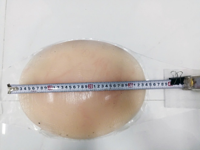 Deo bung bau gia,  Che mat chong,  Tra Vinh anh 2