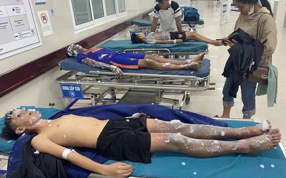 4 hoc sinh bi bong nang do tu che phao no theo YouTube hinh anh