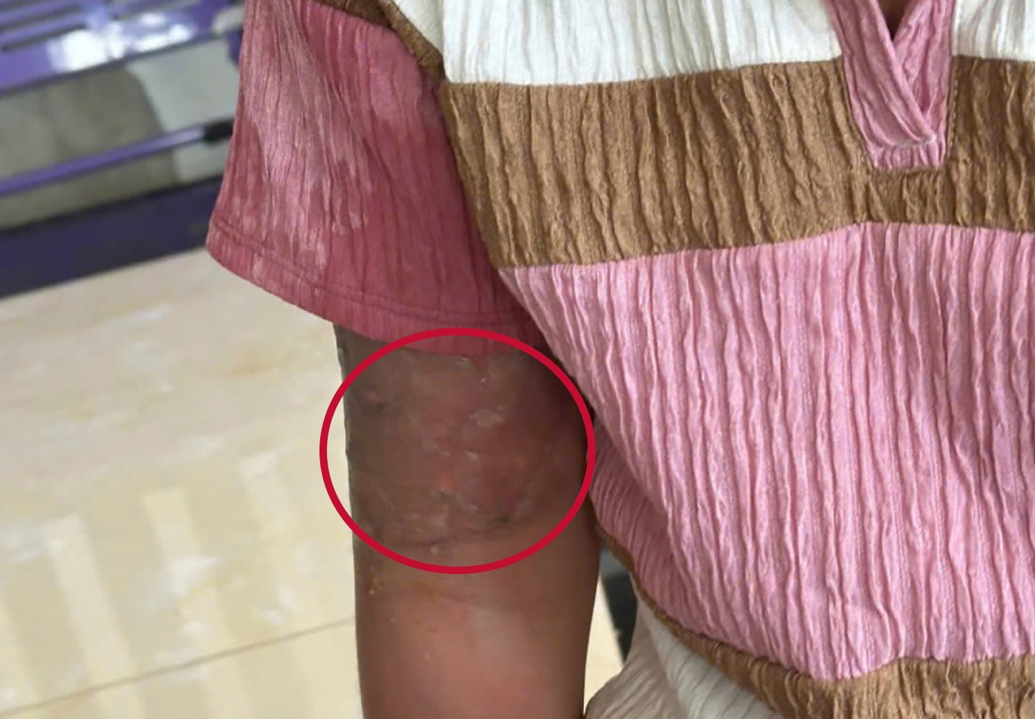 Tat nuoc soi,  Be gai 12 tuoi anh 2